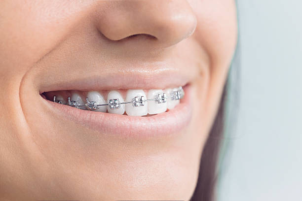 Dental Inlays and Onlays in Parklawn, CA